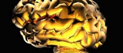 neurologia-em-suzano-1436558850